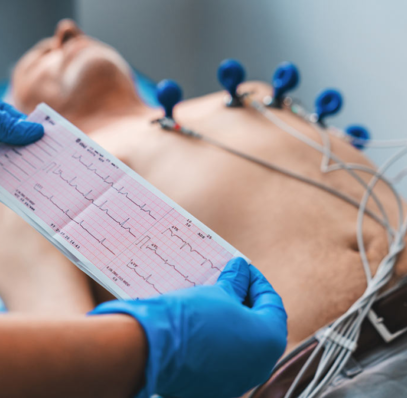 ECG 1
