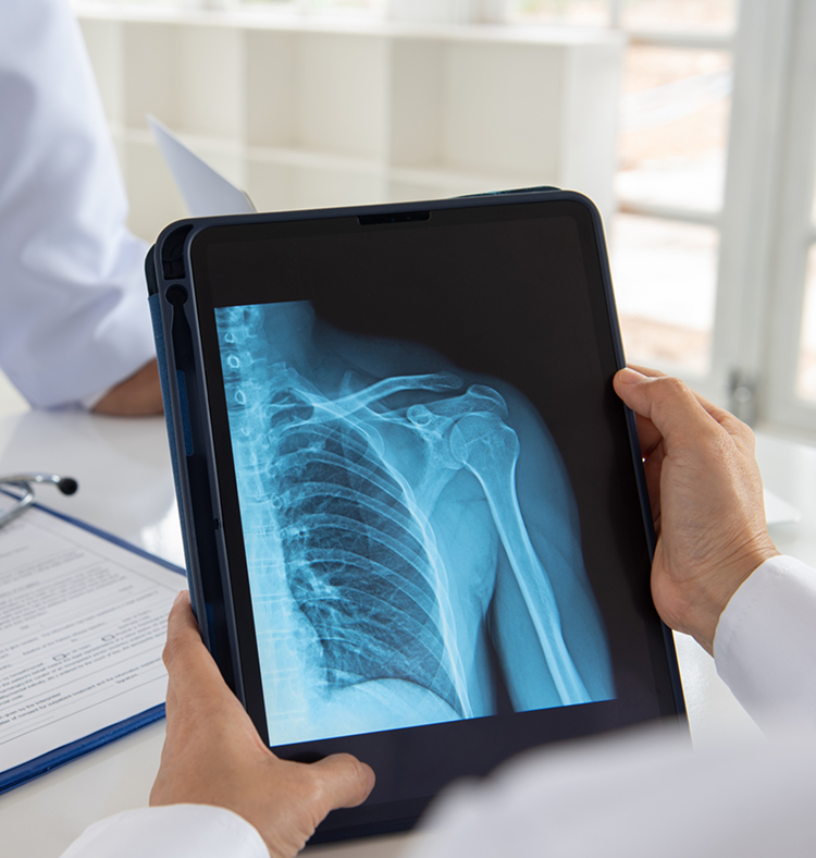 Xray Option 4